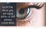 Cần kiểm tra mắt định kỳ để ph&aacute;t hiện sớm bệnh Gl&ocirc;c&ocirc;m