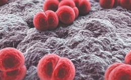 Nguy hiểm bệnh vi&ecirc;m m&agrave;ng n&atilde;o do n&atilde;o m&ocirc; cầu