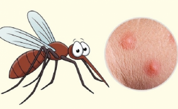 Tại sao muỗi đốt người n&agrave;y nhiều hơn người kh&aacute;c?