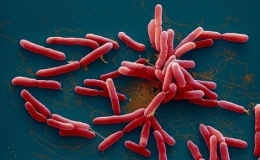 Cục Y tế dự ph&ograve;ng cảnh b&aacute;o thận trọng với bệnh Whitmore