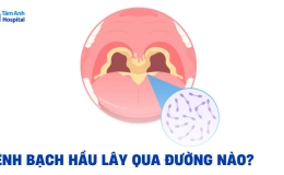 Đường l&acirc;y truyền bệnh bạch hầu