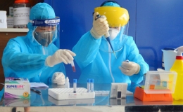 Cả nước ghi nhận 77 ca mắc COVID-19 trong ng&agrave;y 10/1