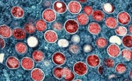 Cả nước c&oacute; 121 ca mắc, 6 ca tử vong do bệnh đậu m&ugrave;a khỉ