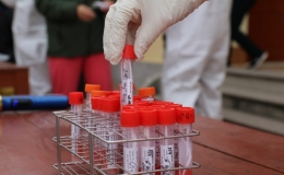 Ch&ugrave;m ca bệnh trong hộ gia đ&igrave;nh ở Hải Dương đ&atilde; t&igrave;m được nguồn l&acirc;y