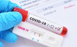 Ch&iacute;nh phủ gia hạn thời gian thanh tra mua sắm kit x&eacute;t nghiệm, vaccine COVID-19