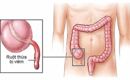 Ruột thừa c&oacute; thừa hay kh&ocirc;ng? Những điều cần biết về ruột thừa  