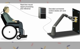 Bệnh nh&acirc;n bị liệt điều khiển c&aacute;nh tay robot bằng suy nghĩ