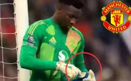 Onana g&acirc;y tranh c&atilde;i khi b&ocirc;i một thứ v&agrave;o găng tay