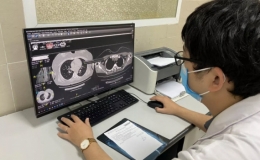 C&aacute;c việc n&ecirc;n l&agrave;m để tr&aacute;nh t&igrave;nh trạng "sương m&ugrave; n&atilde;o" của hậu COVID-19