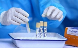 Ph&aacute;t hiện th&ecirc;m 116 ca mắc Covid-19 mới, TP. Hồ Ch&iacute; Minh, B&igrave;nh Dương nhiều ca mắc nhất