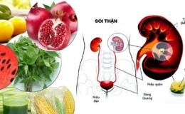 B&aacute;c sĩ gợi &yacute; những thực phẩm &ldquo;v&agrave;ng&rdquo; gi&uacute;p ph&ograve;ng sỏi tiết niệu hiệu quả