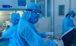 S&aacute;ng 2/7, c&oacute; 151 ca mắc Covid-19, TP Hồ Ch&iacute; Minh nhiều nhất 118 ca