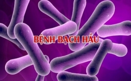 Bệnh bạch hầu l&acirc;y truyền như thế n&agrave;o?