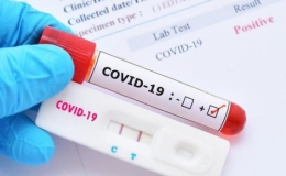 Bộ Y tế c&ocirc;ng bố 7 loại test nhanh SARS-CoV-2, trong đ&oacute; 3 loại được điều chỉnh gi&aacute;