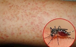 Số ca mắc sốt xuất huyết vẫn ở mức cao