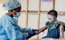 WHO khẩn cấp ứng ph&oacute; bệnh đậu m&ugrave;a khỉ