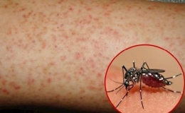 Biện ph&aacute;p tr&aacute;nh bị muỗi đốt, ph&ograve;ng tr&aacute;nh hiệu quả sốt xuất huyết