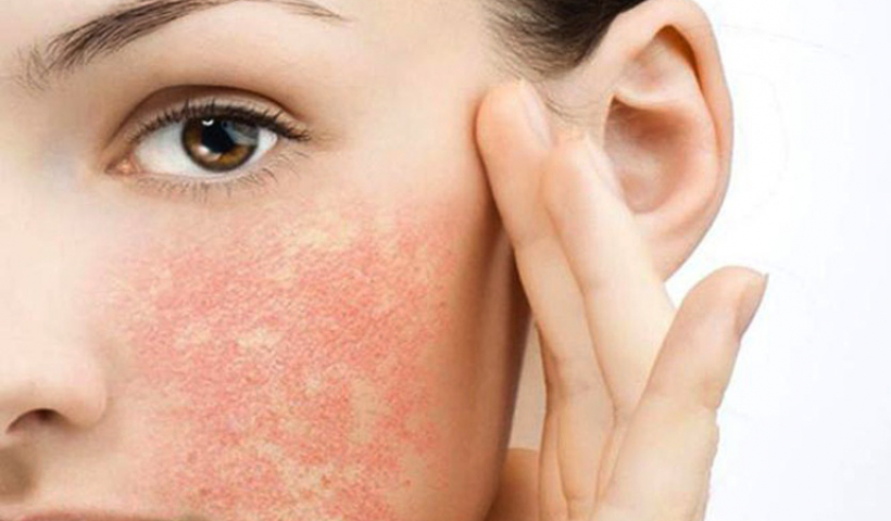 Hậu quả do sử dụng mỹ phẩm kh&ocirc;ng nguồn gốc 