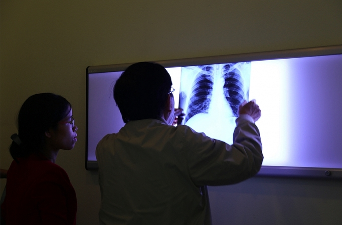 nganh tam lop fibro xi mang va noi tran tro 20 nam cua doanh nghiep