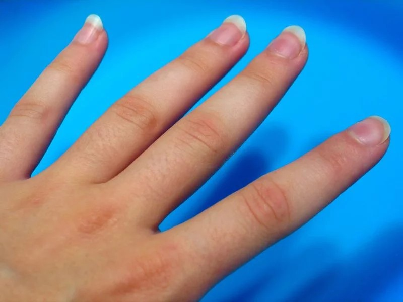 10 triệu chứng của bệnh viêm phổi hình 7 10 trieu chung cua benh viem phoi hinh 7