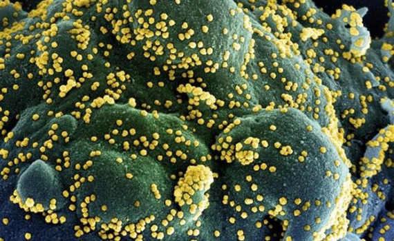 Phát hiện biến thể mới của virus SARS-CoV-2 chứa 46 đột biến