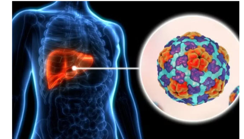 Số ca tăng vọt, Los Angeles (Mỹ) tuy&ecirc;n bố b&ugrave;ng ph&aacute;t dịch vi&ecirc;m gan A