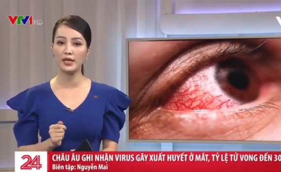 Châu Âu ghi nhận virus gây xuất huyết ở mắt, tỷ lệ tử vong đến 30%